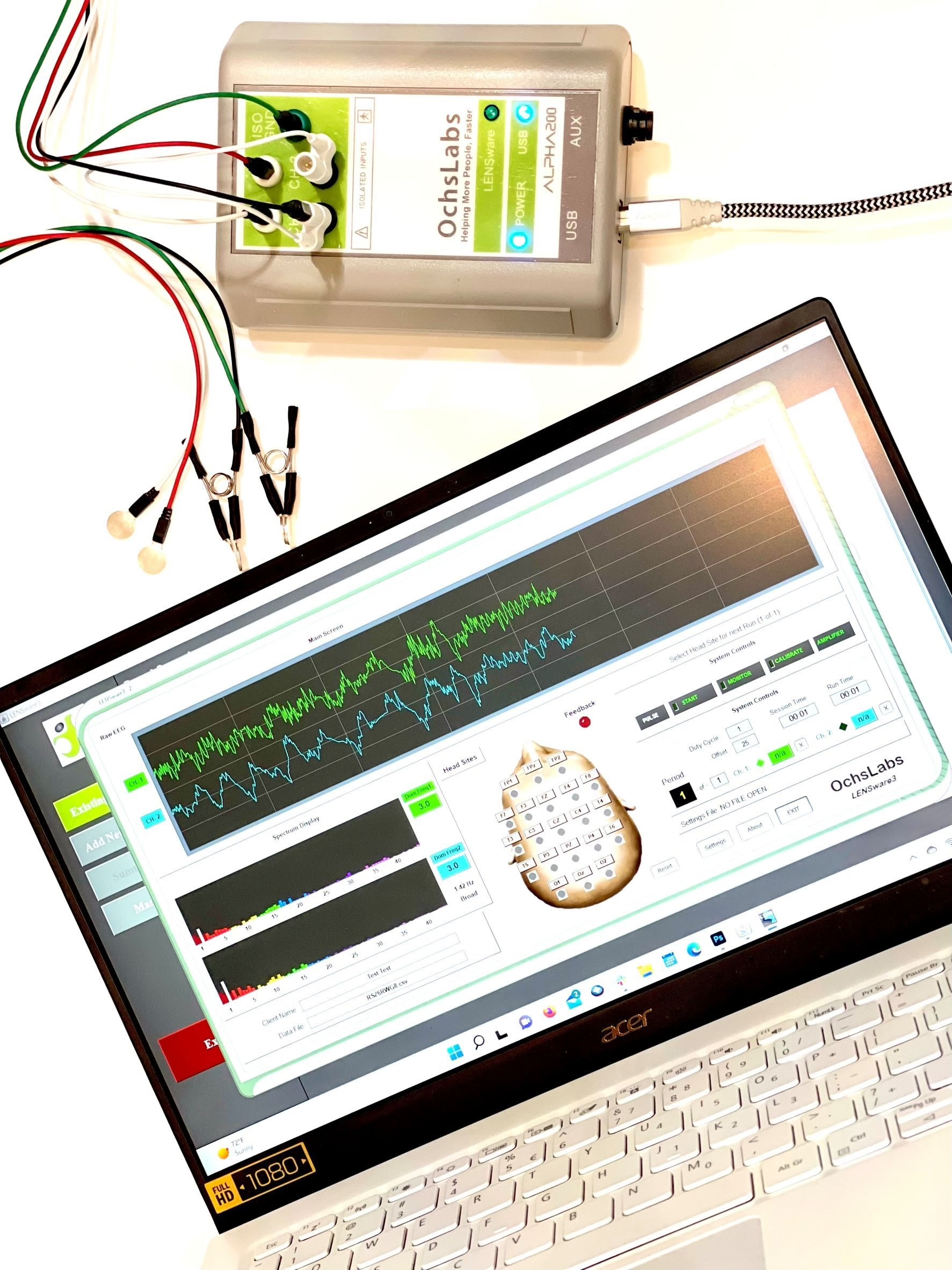OchsLabs Alpha 200 LENS device with electrode leads and monitoring software interface